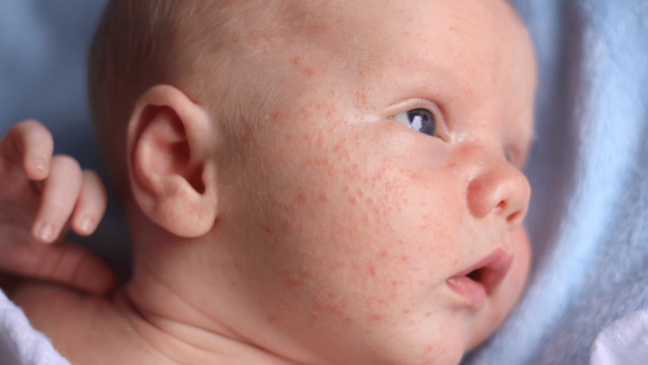 finding-the-right-baby-skin-care-products-healthy-solutions