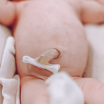 Newborn's Umbilical Cord Caring Practices