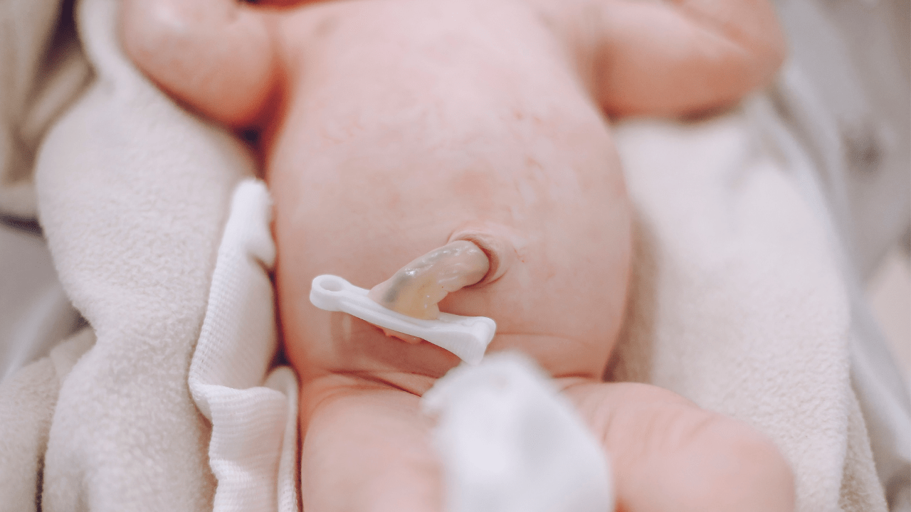 Newborn's Umbilical Cord Caring Practices